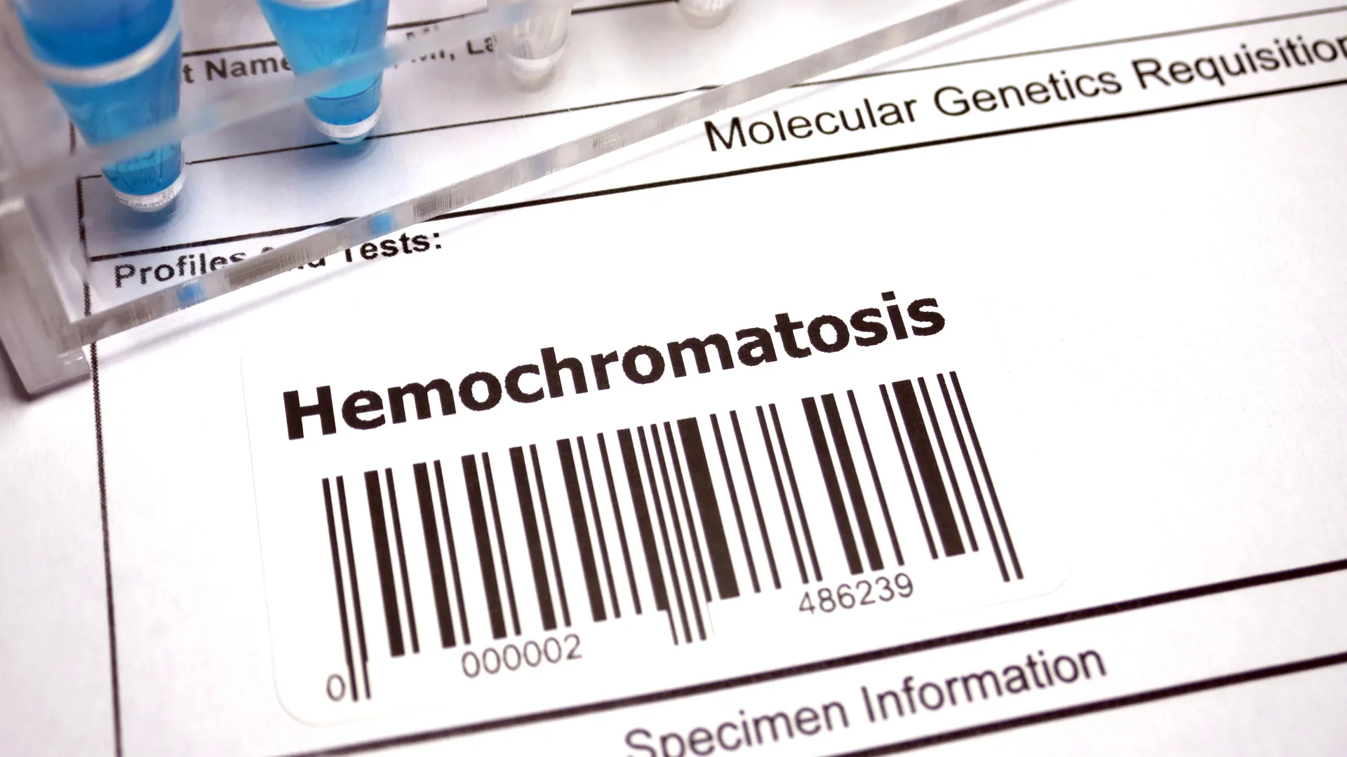 Hemochromatosis